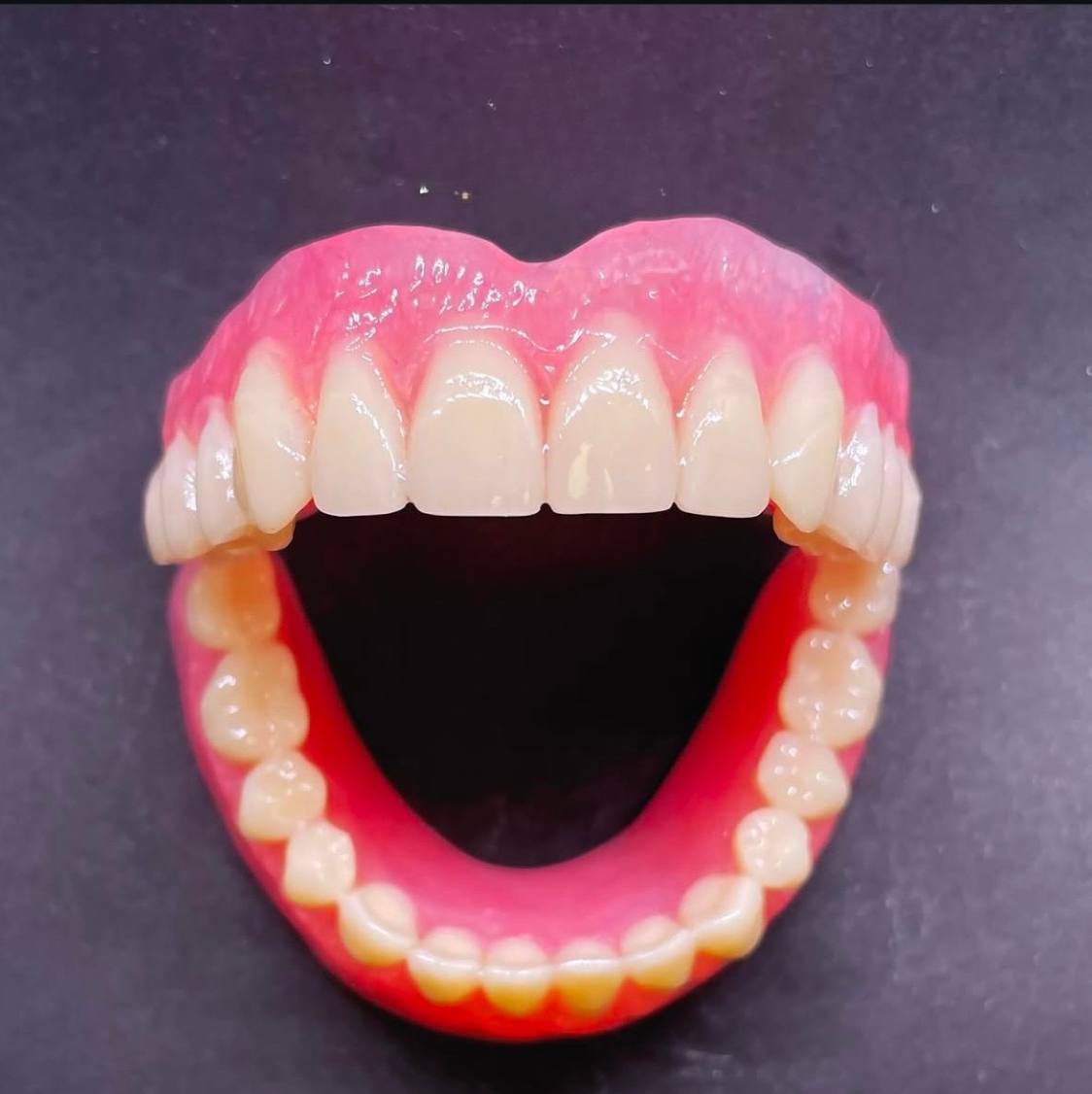 Prótesis dental removible